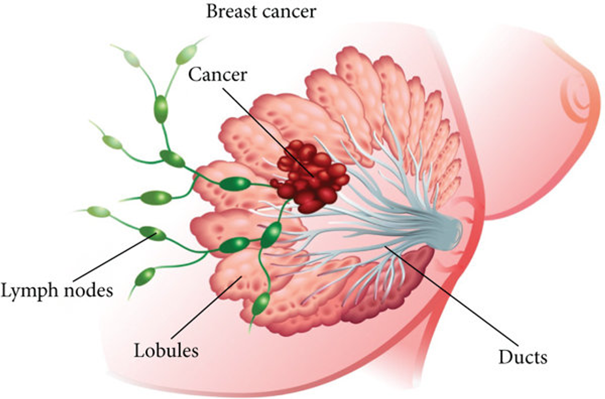 乳房结构/小叶/导管/ducts/lobules